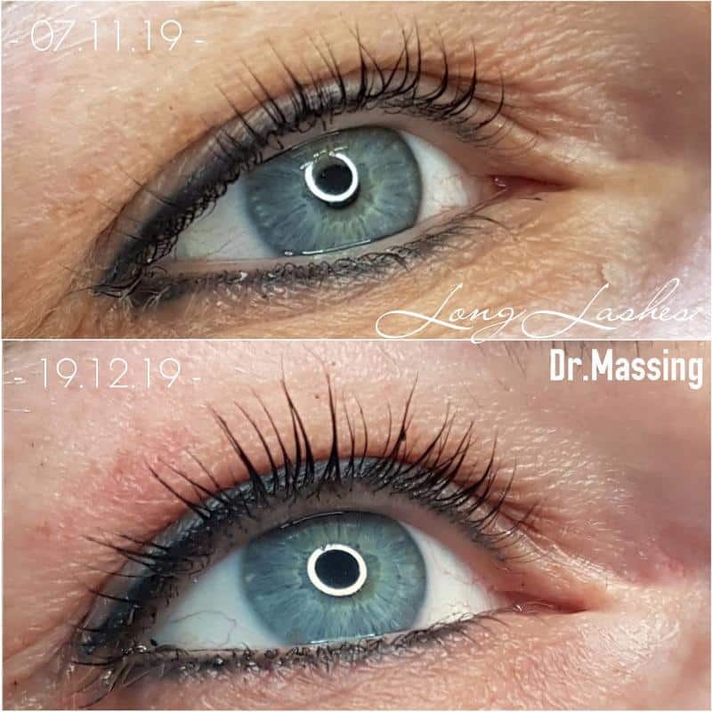 LONG LASHES Wimpernserum 3 ml von Dr. Massing - Augenpflege von Dr. Massing Cosmetics bei Beautystore Schweiz