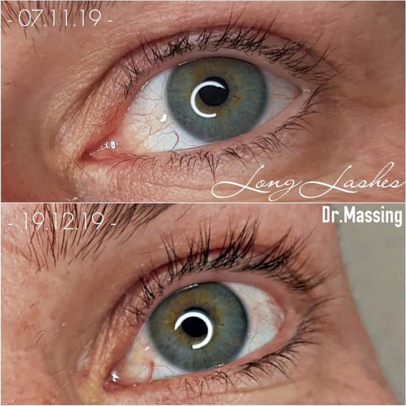 LONG LASHES Wimpernserum 3 ml von Dr. Massing - Augenpflege von Dr. Massing Cosmetics bei Beautystore Schweiz